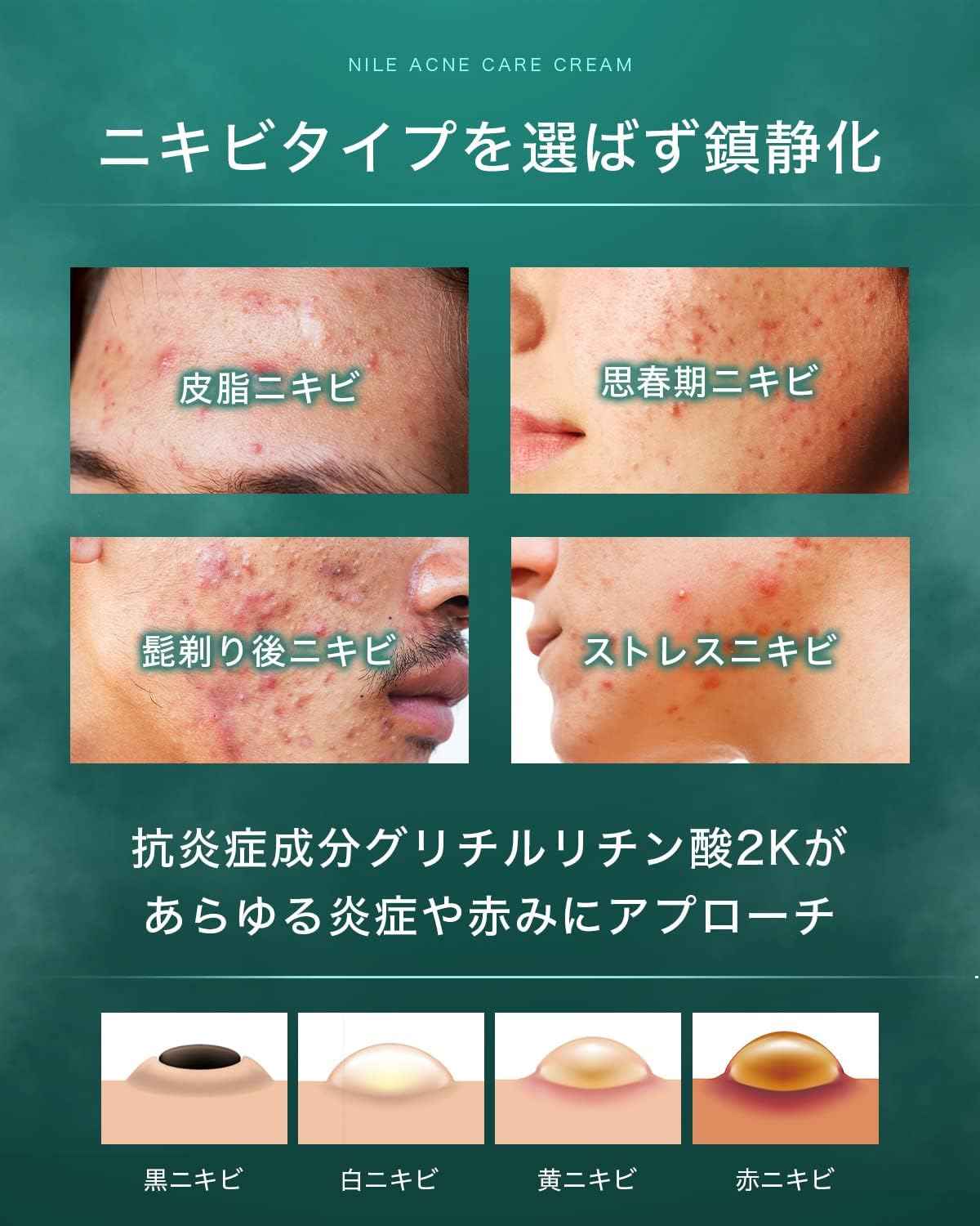 NILE Acne Cream 男女曬後護理 (尤加利薄荷香) 醫藥部外品