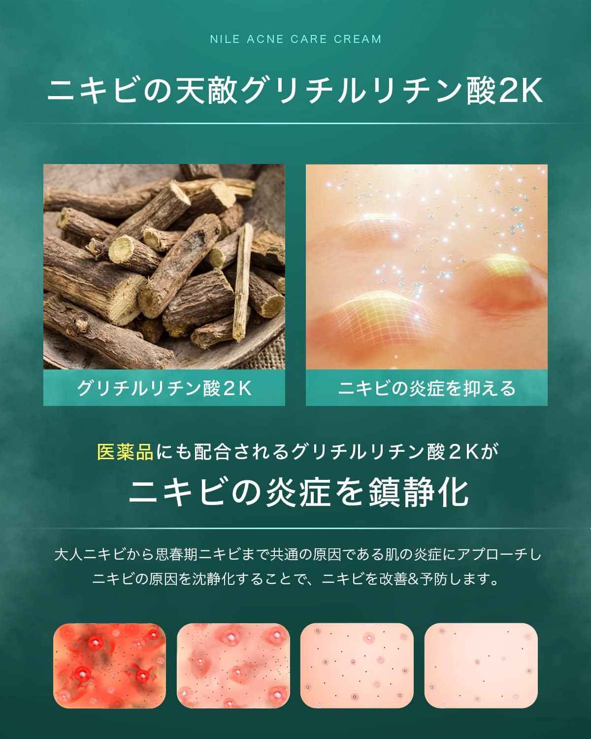 NILE Acne Cream 男女曬後護理 (尤加利薄荷香) 醫藥部外品